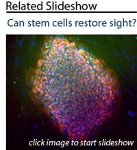click picture to see slideshow of Stephen Tsang's stem cell research